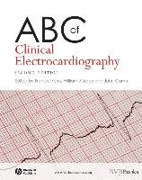 ABC of Clinical Electrocardiography