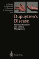 Dupuytren's Disease