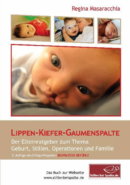 Lippen-Kiefer-Gaumenspalte