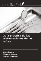 Guía práctica de las restauraciones de las raíces